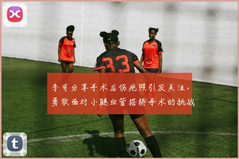 李可分享手术后伤疤照引发关注，勇敢面对小腿血管搭桥手术的挑战